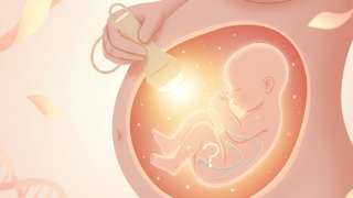 胎儿四维彩超图性别（胎儿四维彩超图性别怎么看）？医生深度揭秘真相